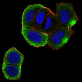 CK2 beta Mouse Monoclonal Antibody