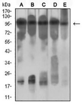 CD131 Mouse Monoclonal Antibody