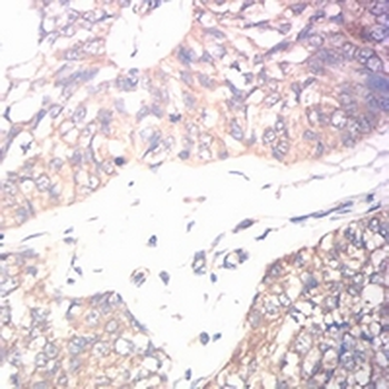 CD131 Mouse Monoclonal Antibody