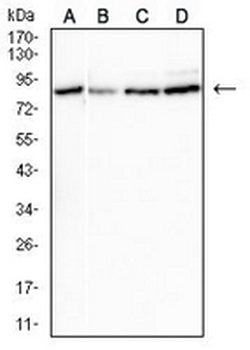 CPT2 Mouse Monoclonal Antibody
