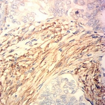 CNN3 Mouse Monoclonal Antibody