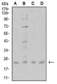 CIRBP Mouse Monoclonal Antibody