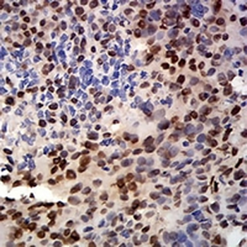 CIRBP Mouse Monoclonal Antibody