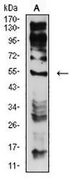 CHRNE Mouse Monoclonal Antibody