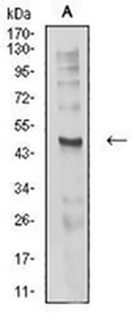 AChR delta Mouse Monoclonal Antibody