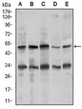 Chromogranin A Mouse Monoclonal Antibody