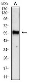 Chromogranin A Mouse Monoclonal Antibody