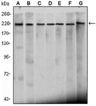 CHD3 Mouse Monoclonal Antibody