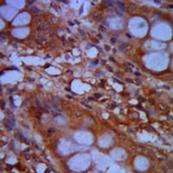 CHD3 Mouse Monoclonal Antibody