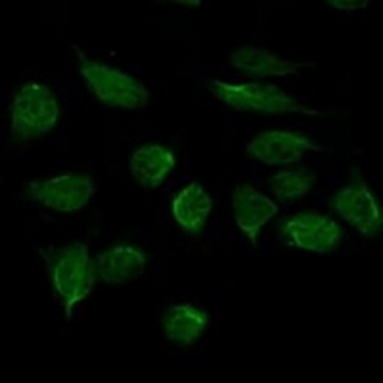 CHD3 Mouse Monoclonal Antibody