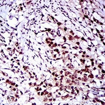 c-FLIP Mouse Monoclonal Antibody