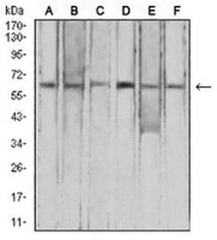 FHR-5 Mouse Monoclonal Antibody