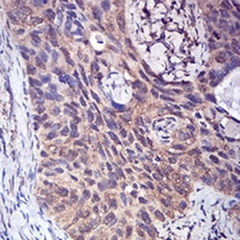 FHR-5 Mouse Monoclonal Antibody