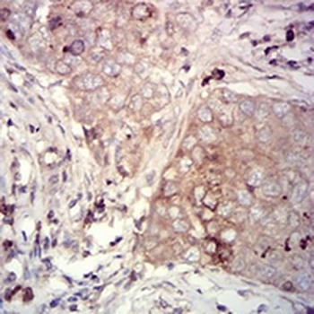 CD66a Mouse Monoclonal Antibody