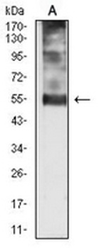 p57 Kip2 Mouse Monoclonal Antibody