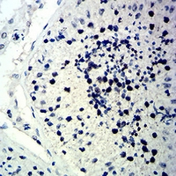 p57 Kip2 Mouse Monoclonal Antibody