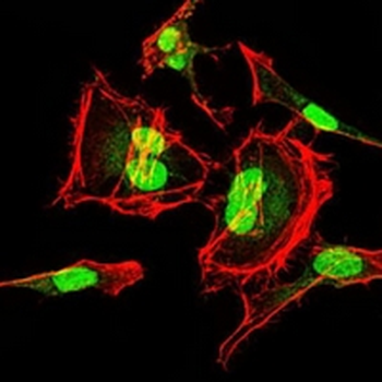 CDK2 Mouse Monoclonal Antibody