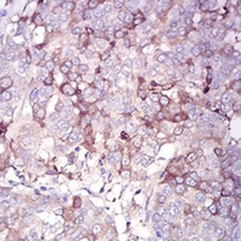 OB Cadherin Mouse Monoclonal Antibody