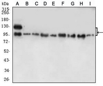 E Cadherin Mouse Monoclonal Antibody