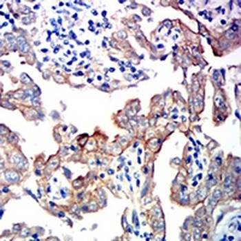 E Cadherin Mouse Monoclonal Antibody