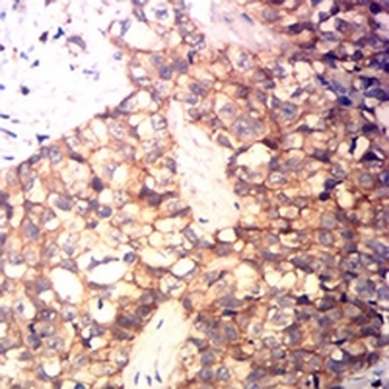 CD99 Mouse Monoclonal Antibody