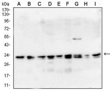 CD81 Mouse Monoclonal Antibody