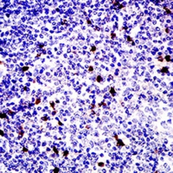 CD81 Mouse Monoclonal Antibody