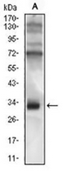 CD74 Mouse Monoclonal Antibody