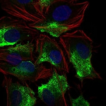 CD74 Mouse Monoclonal Antibody
