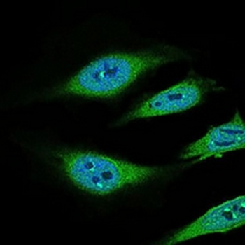 CD68 Mouse Monoclonal Antibody