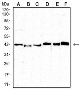 CD5 Mouse Monoclonal Antibody