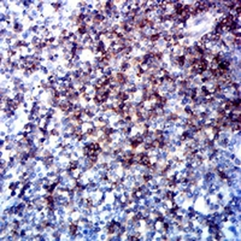 CD5 Mouse Monoclonal Antibody