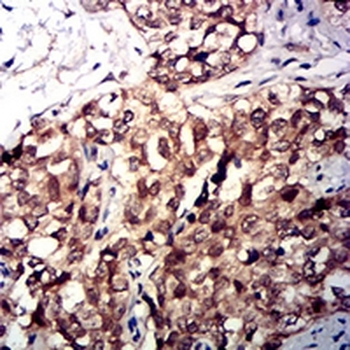 CD47 Mouse Monoclonal Antibody
