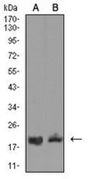 CD3d Mouse Monoclonal Antibody