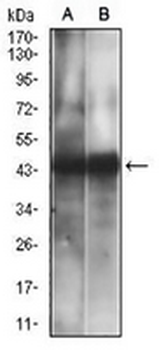 CD38 Mouse Monoclonal Antibody