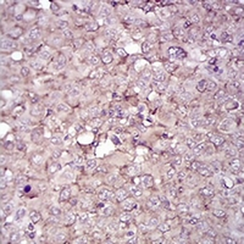 CD38 Mouse Monoclonal Antibody