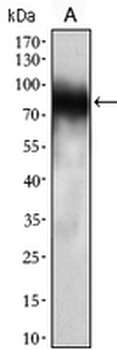 CD33 Mouse Monoclonal Antibody
