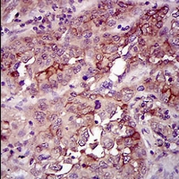 CD33 Mouse Monoclonal Antibody