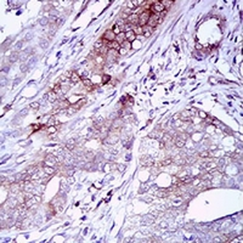 CD22 Mouse Monoclonal Antibody