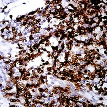 CD2 Mouse Monoclonal Antibody