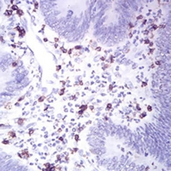 CD2 Mouse Monoclonal Antibody