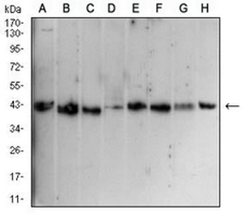 CD1a Mouse Monoclonal Antibody