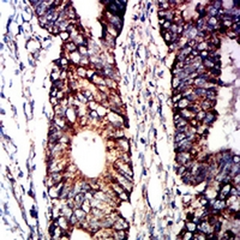 CD1a Mouse Monoclonal Antibody