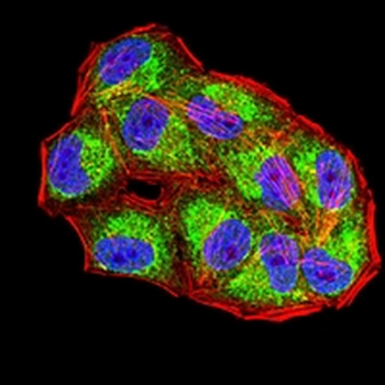 CD1a Mouse Monoclonal Antibody