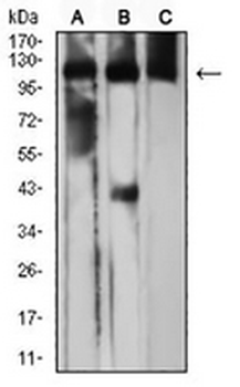 CD163 Mouse Monoclonal Antibody