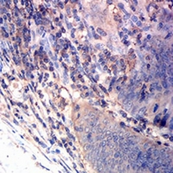 CD163 Mouse Monoclonal Antibody