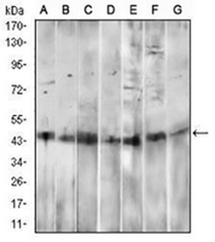 CD14 Mouse Monoclonal Antibody