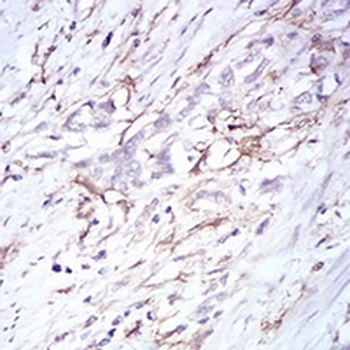 CD14 Mouse Monoclonal Antibody