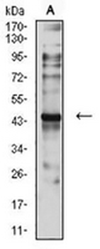 CCR7 Mouse Monoclonal Antibody