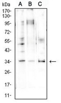 Cyclin D1 Mouse Monoclonal Antibody